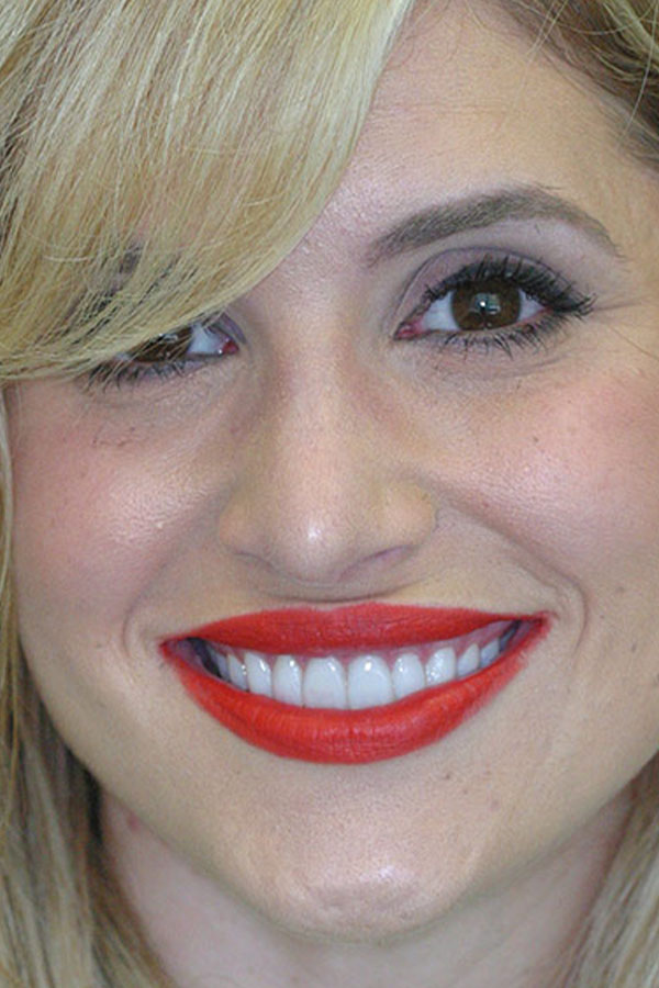 before and after patient testimonials cosmetic dentist of houston