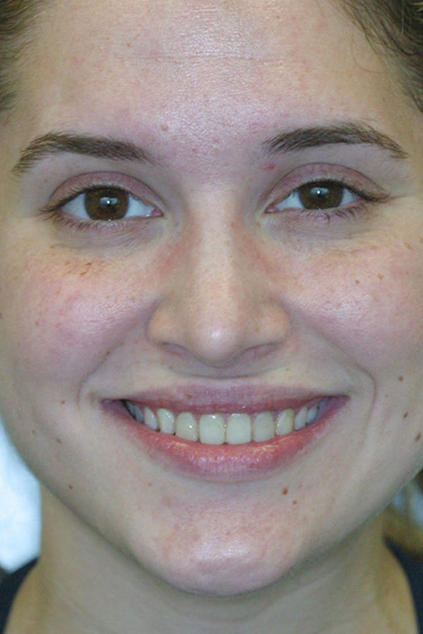 dentistry before and after in houston